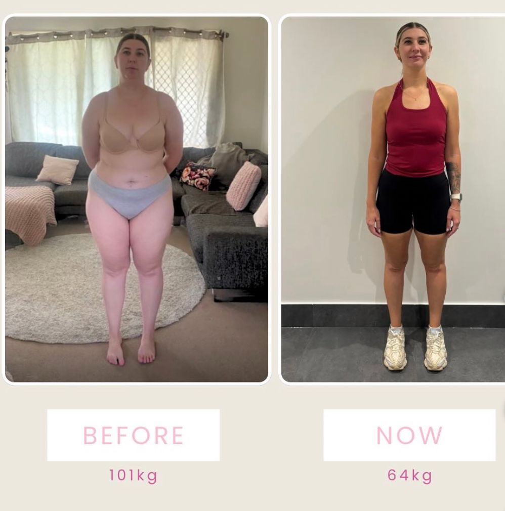 Krystal's transformation, front-on before and after, 101kg to 64kg
